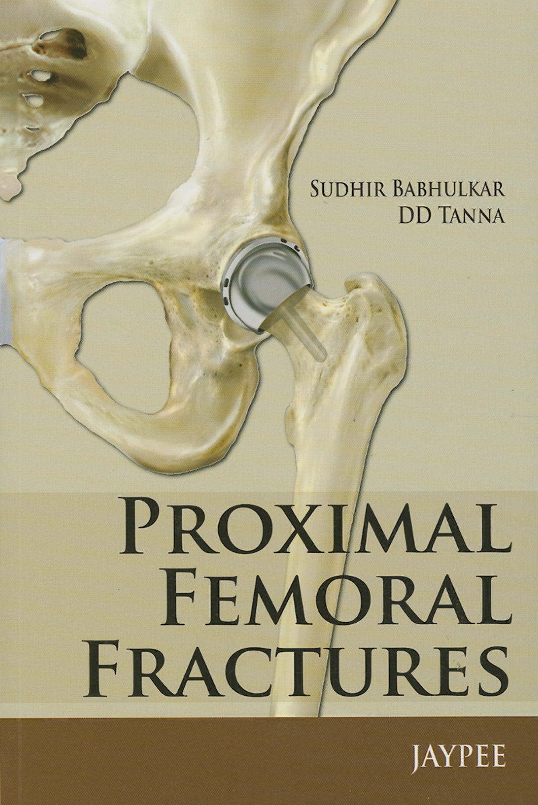 Cover image for Proximal Femoral Fractures ISBN 9789350903711